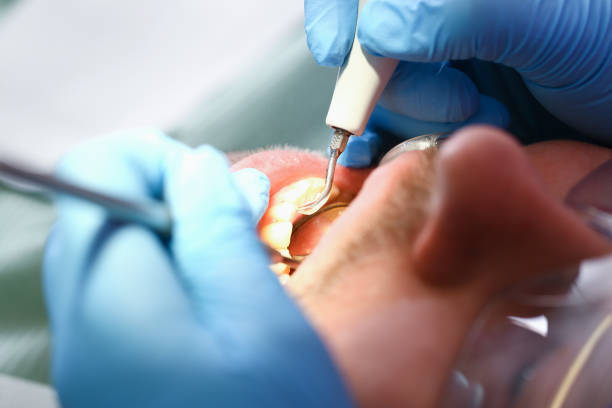 Best Broken or Chipped Tooth Repair in University Gardens, NY