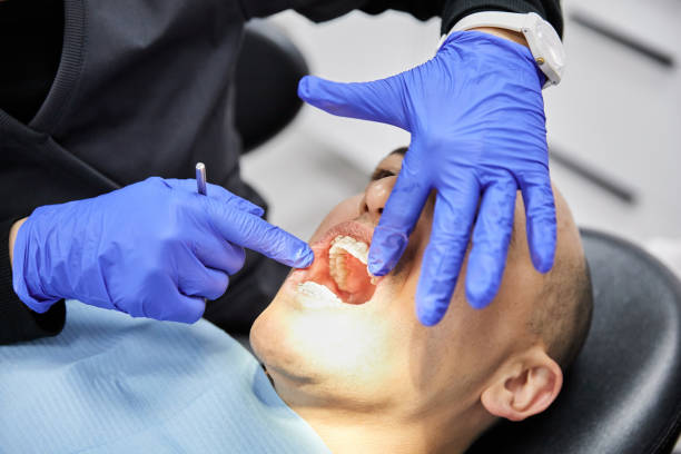 Best Broken or Chipped Tooth Repair in University Gardens, NY